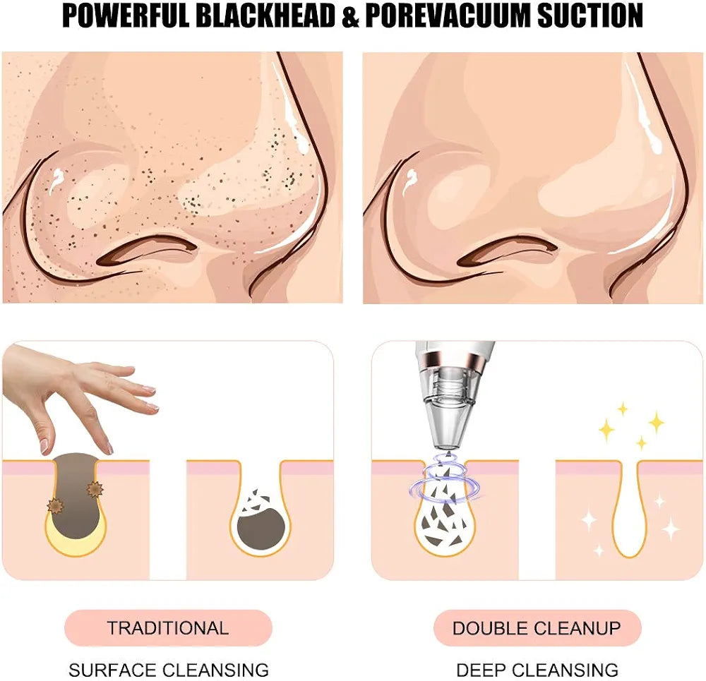 Blackhead Remover Unboxing | 3 Suction Modes